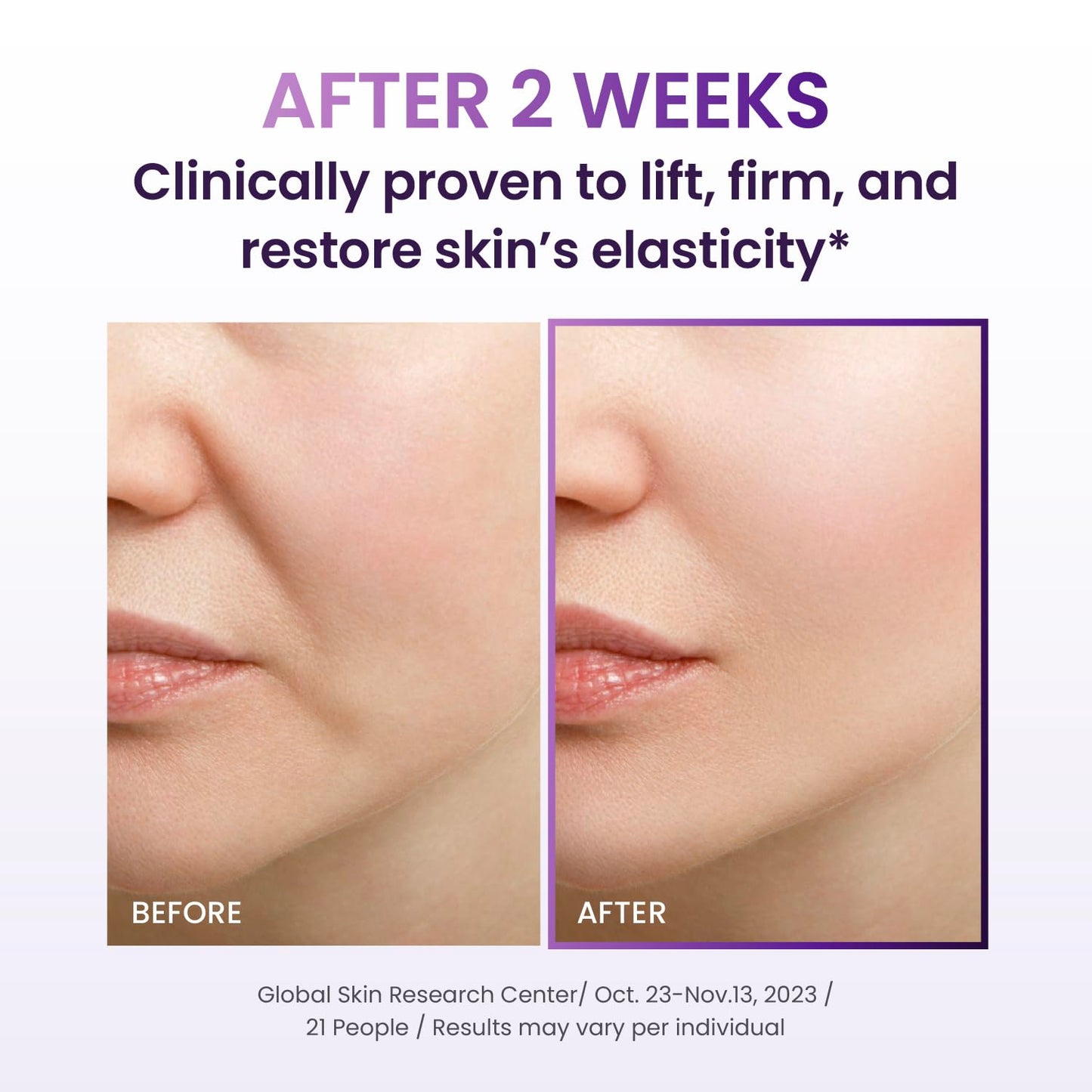 BIOHEAL BOH Probioderm 3D Lifting Cream