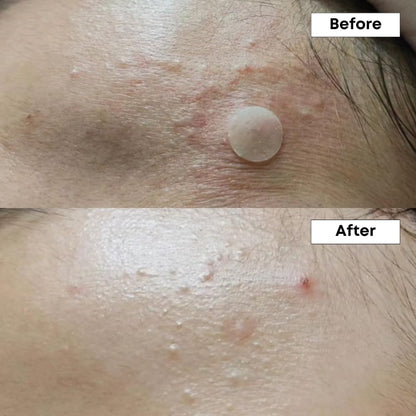 NINELESS A-Control 10% Azelaic Acid Serum