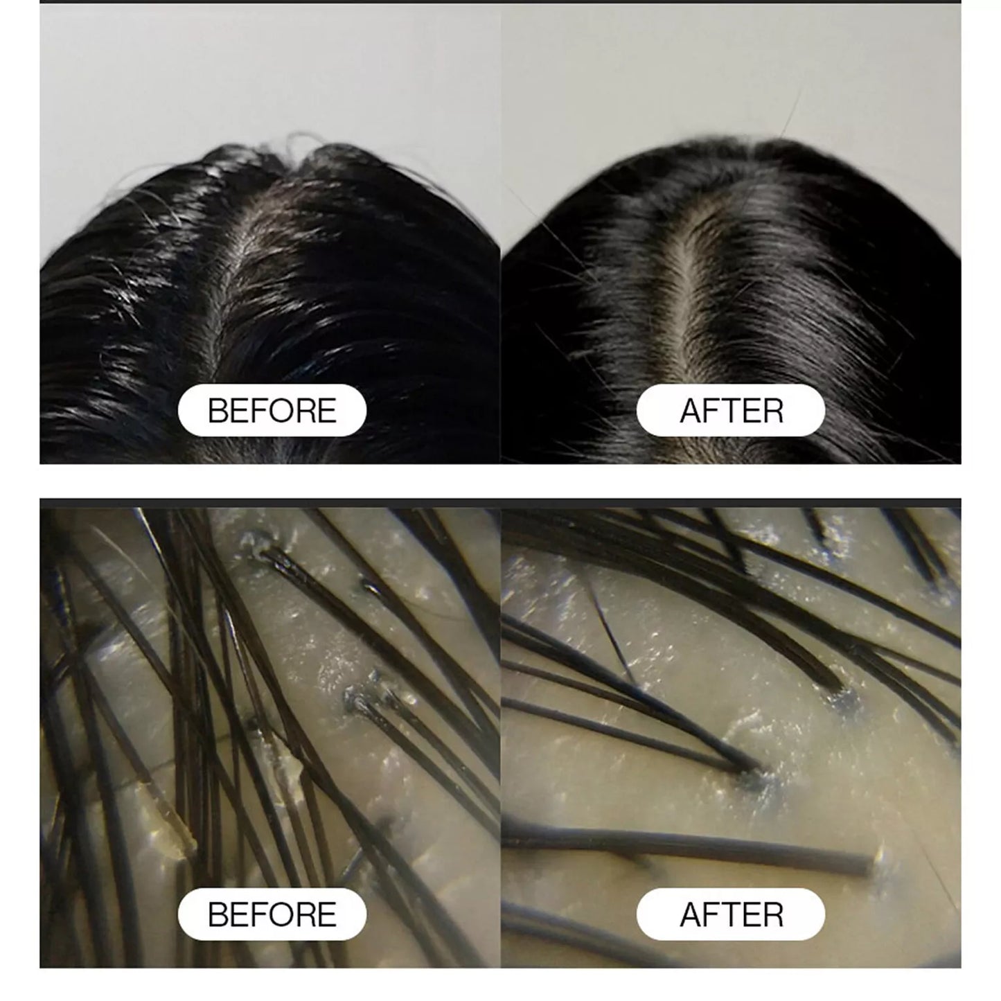 GROWUS Sea Salt Therapy Scalp Scaler